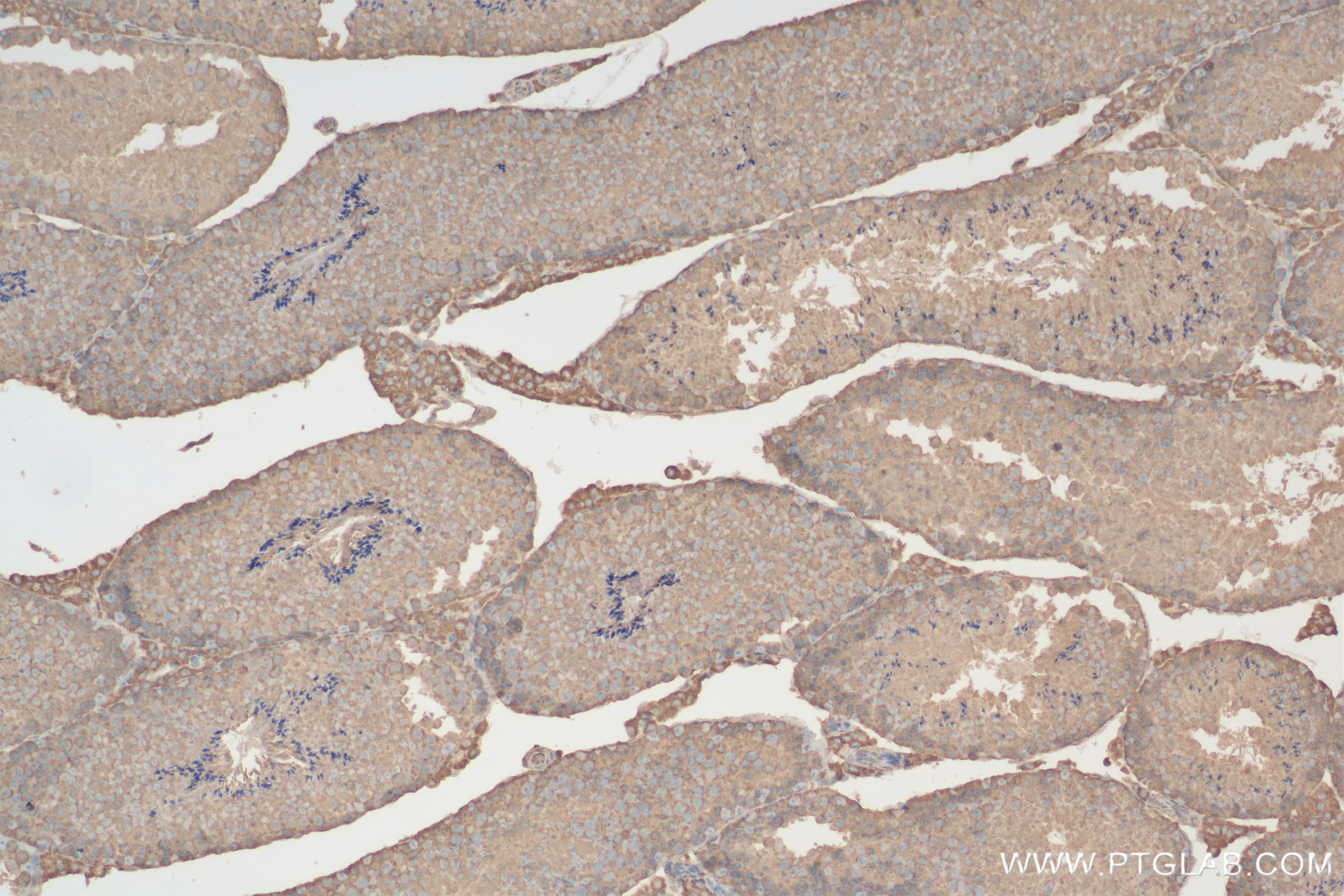 Immunohistochemistry (IHC) staining of mouse testis tissue using HSP90 Recombinant antibody (83950-5-RR)