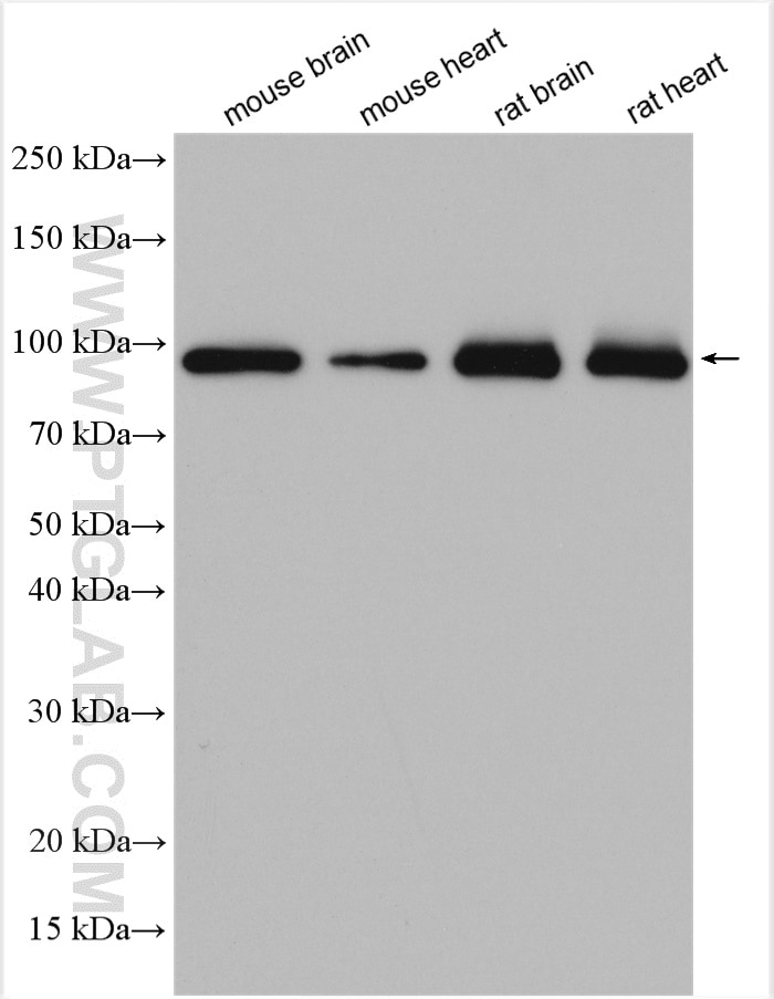 Western Blot (WB) analysis of various lysates using HSP90AB1 Polyclonal antibody (11405-1-AP)