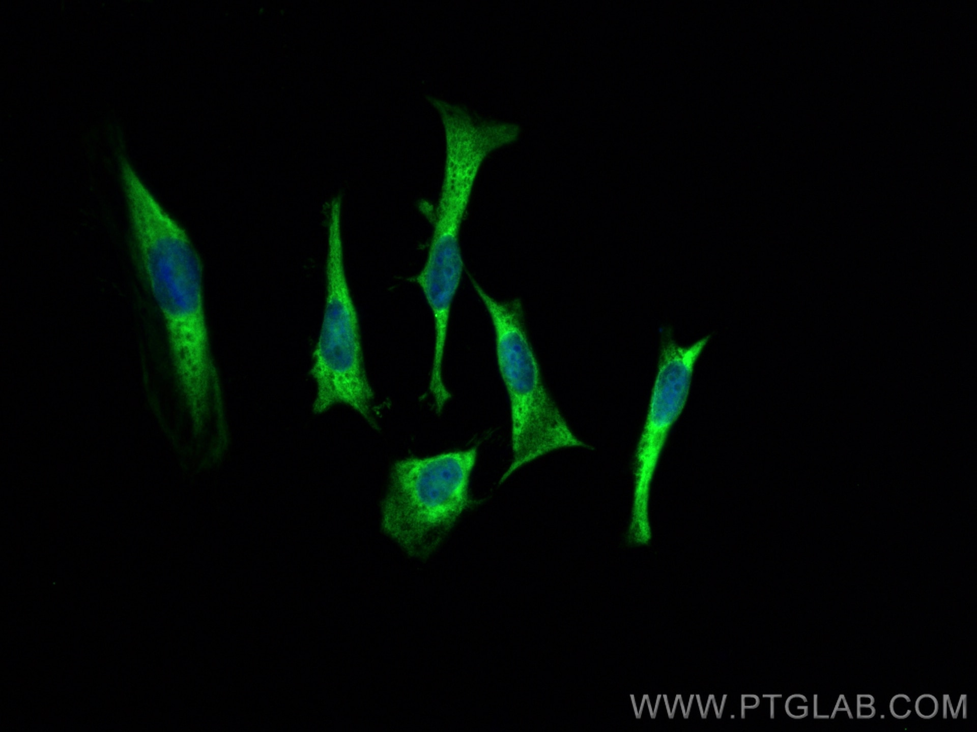 Immunofluorescence (IF) / fluorescent staining of HeLa cells using HSP90AB1 Recombinant antibody (80301-1-RR)