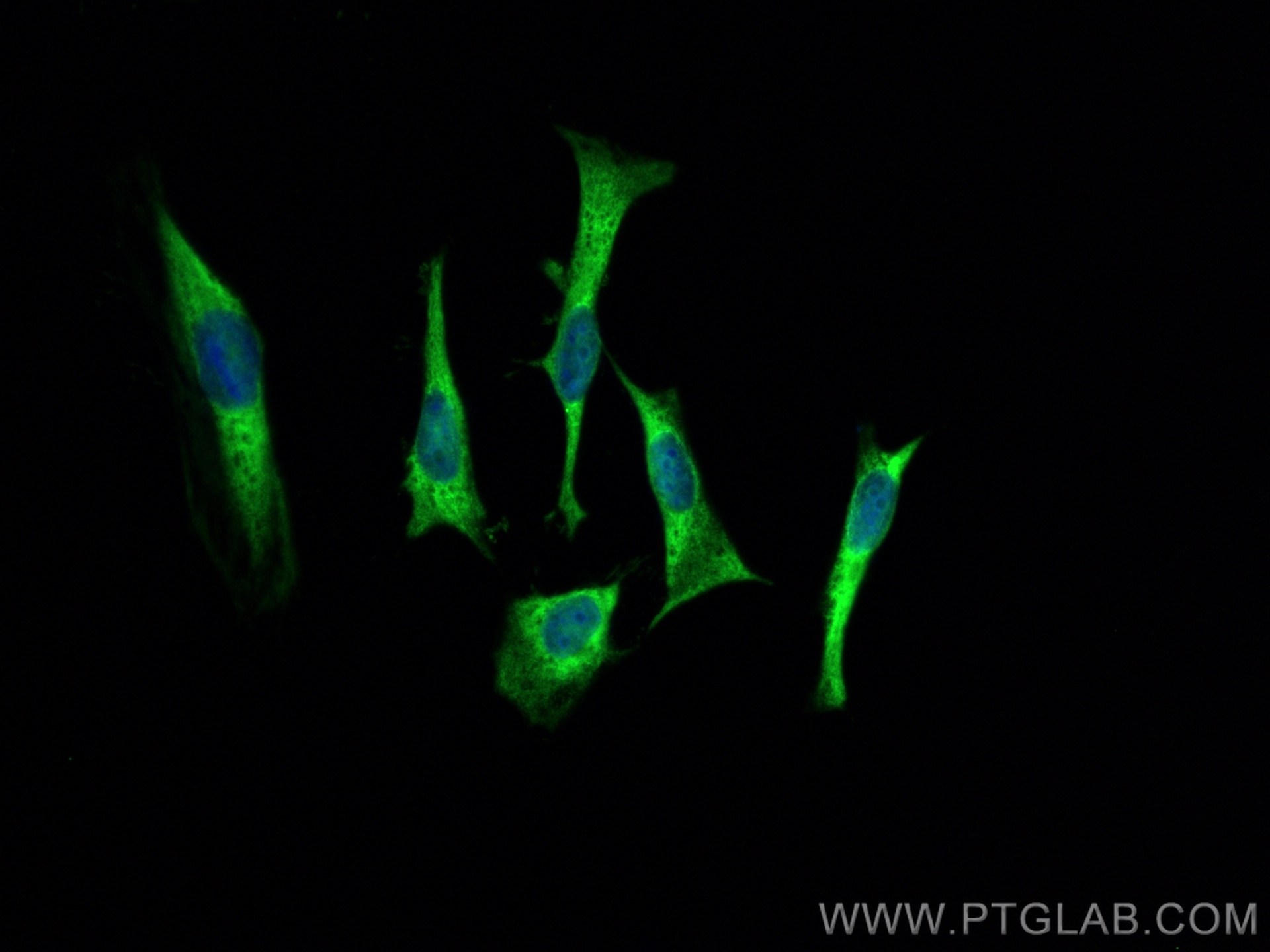 IF Staining of HeLa using 80301-1-RR