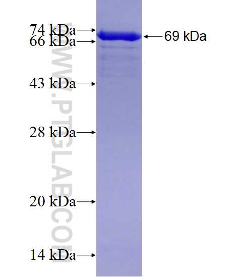 HSP90AB1 fusion protein Ag1947 SDS-PAGE