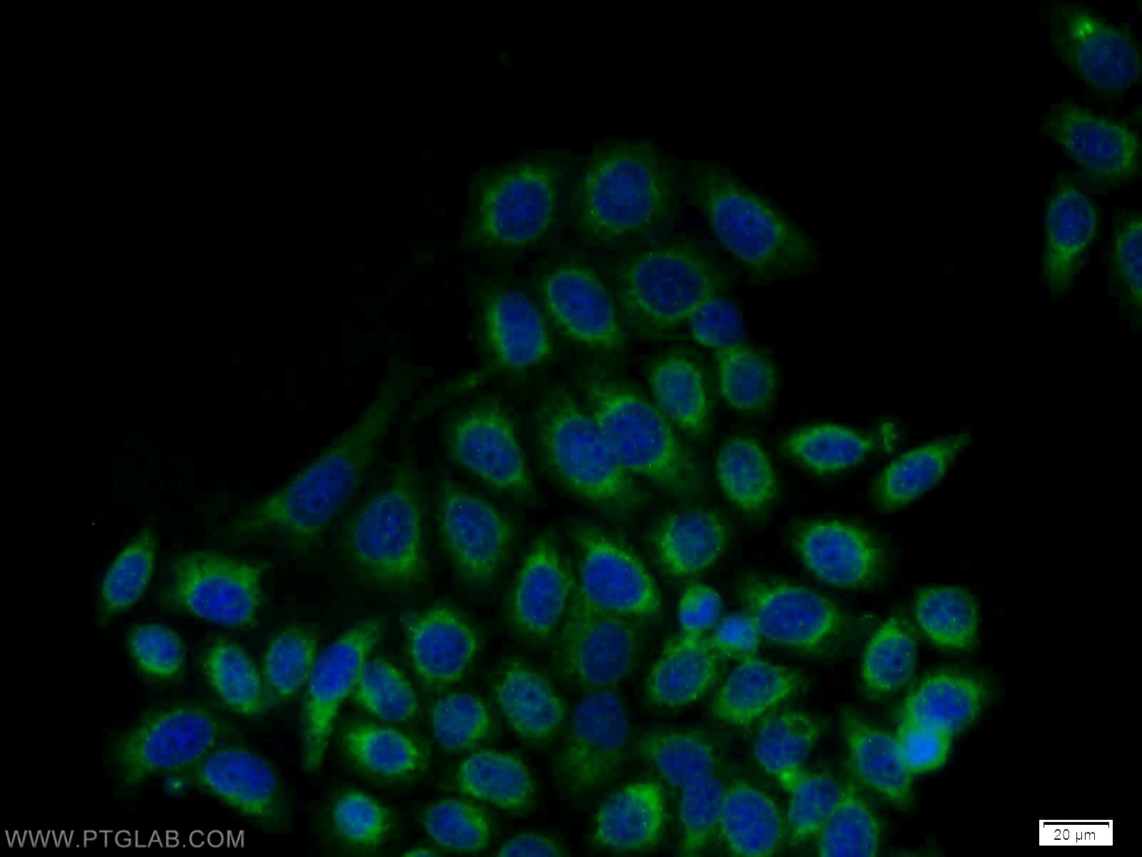 Immunofluorescence (IF) / fluorescent staining of MCF-7 cells using GRP94 Polyclonal antibody (10979-1-AP)