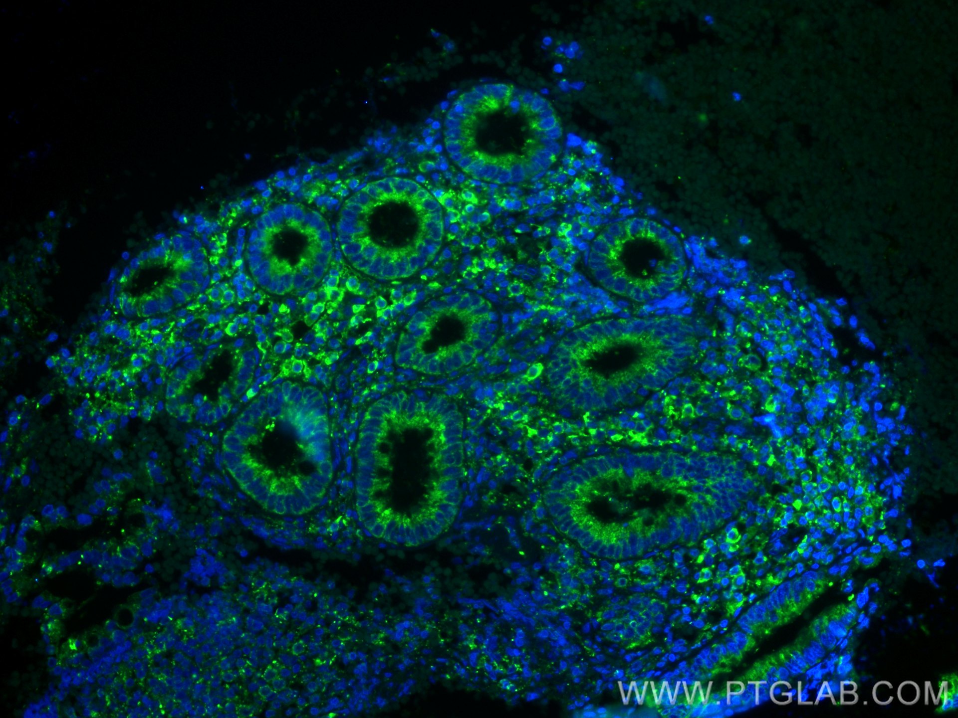Immunofluorescence (IF) / fluorescent staining of human appendicitis tissue using GRP94 Polyclonal antibody (10979-1-AP)