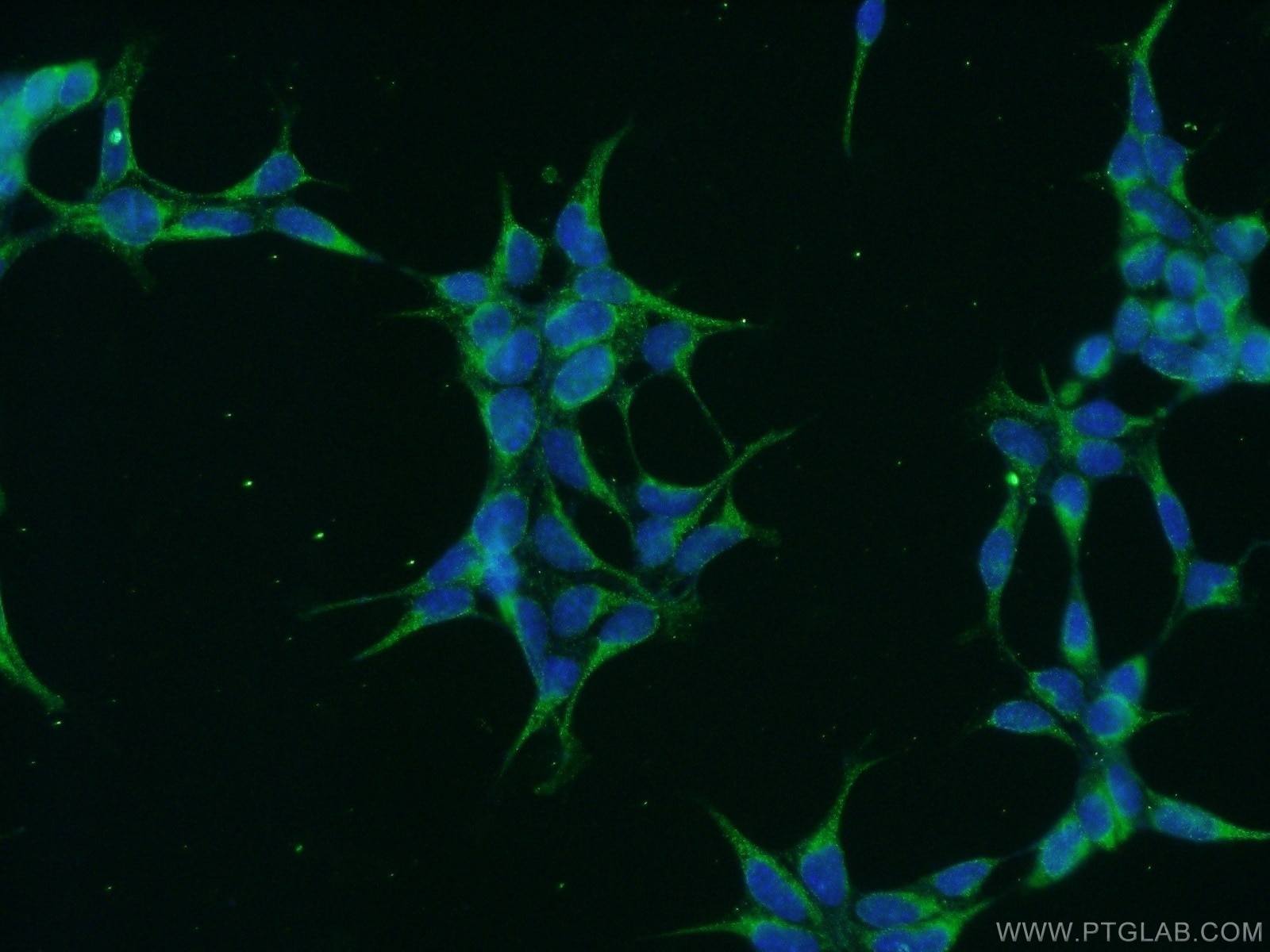 Immunofluorescence (IF) / fluorescent staining of HEK-293 cells using GRP94 Polyclonal antibody (10979-1-AP)