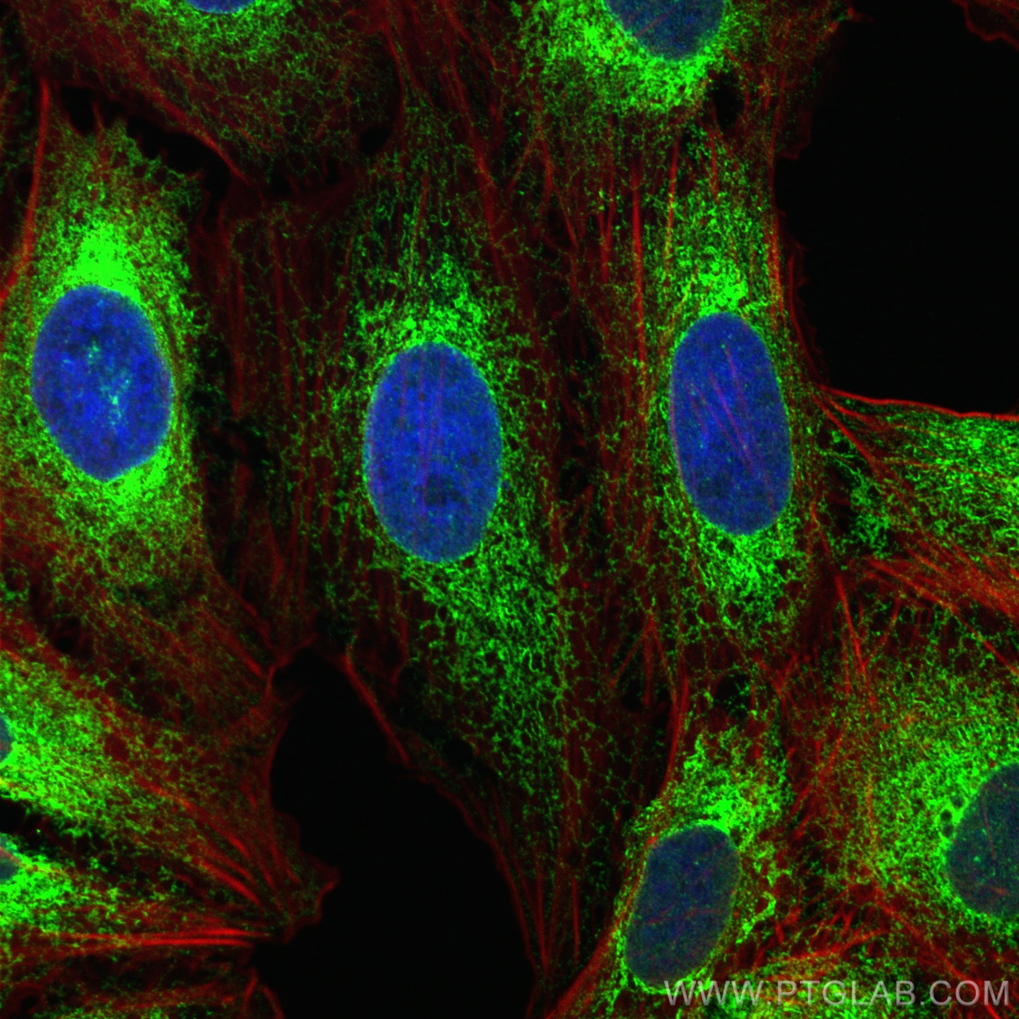 Immunofluorescence (IF) / fluorescent staining of U2OS cells using GRP94 Polyclonal antibody (10979-1-AP)