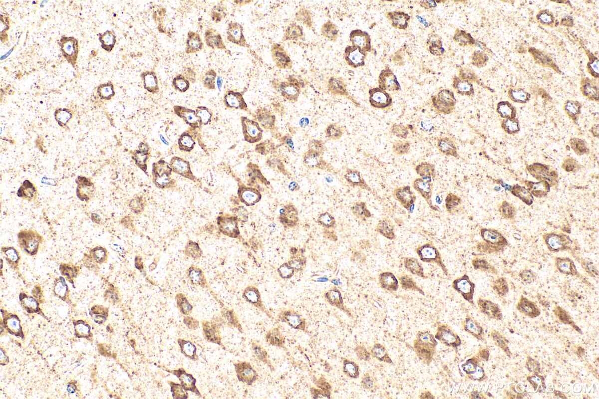Immunohistochemistry (IHC) staining of mouse brain tissue using GRP94 Polyclonal antibody (10979-1-AP)