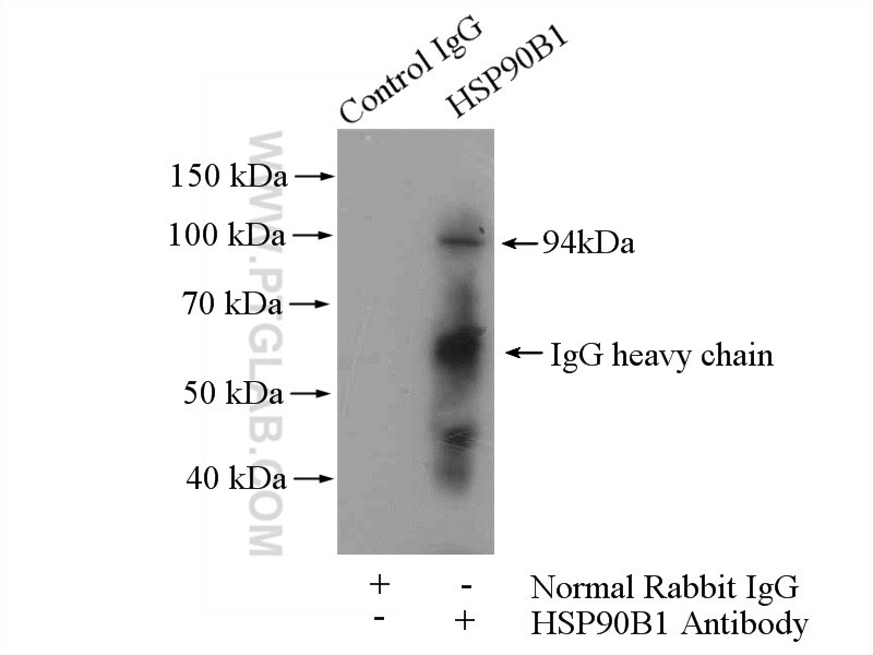 IP experiment of MCF-7 using 10979-1-AP