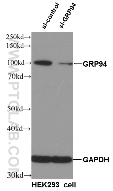 Western Blot (WB) analysis of HEK-293 cells using GRP94 Polyclonal antibody (10979-1-AP)