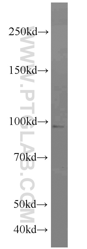 WB analysis of K-562 using 10979-1-AP