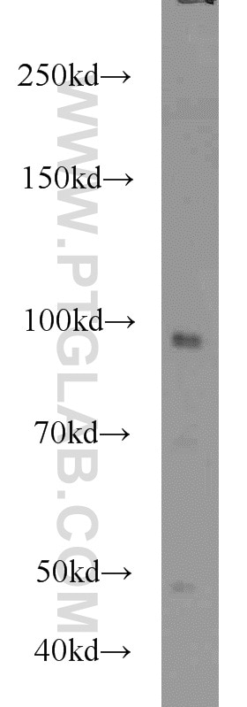 Western Blot (WB) analysis of NIH/3T3 cells using GRP94 Polyclonal antibody (10979-1-AP)