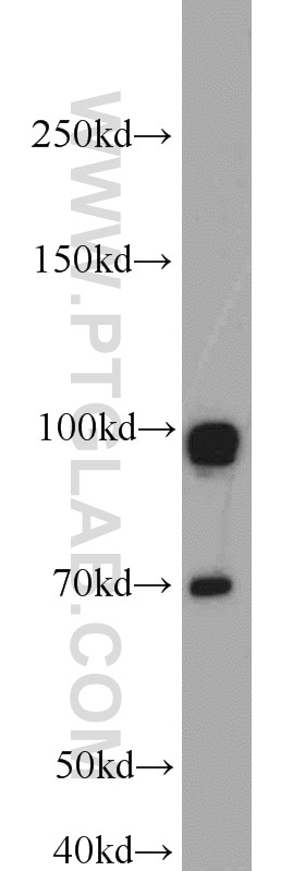 Western Blot (WB) analysis of MCF-7 cells using GRP94 Polyclonal antibody (10979-1-AP)