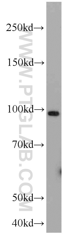 Western Blot (WB) analysis of A549 cells using GRP94 Polyclonal antibody (10979-1-AP)