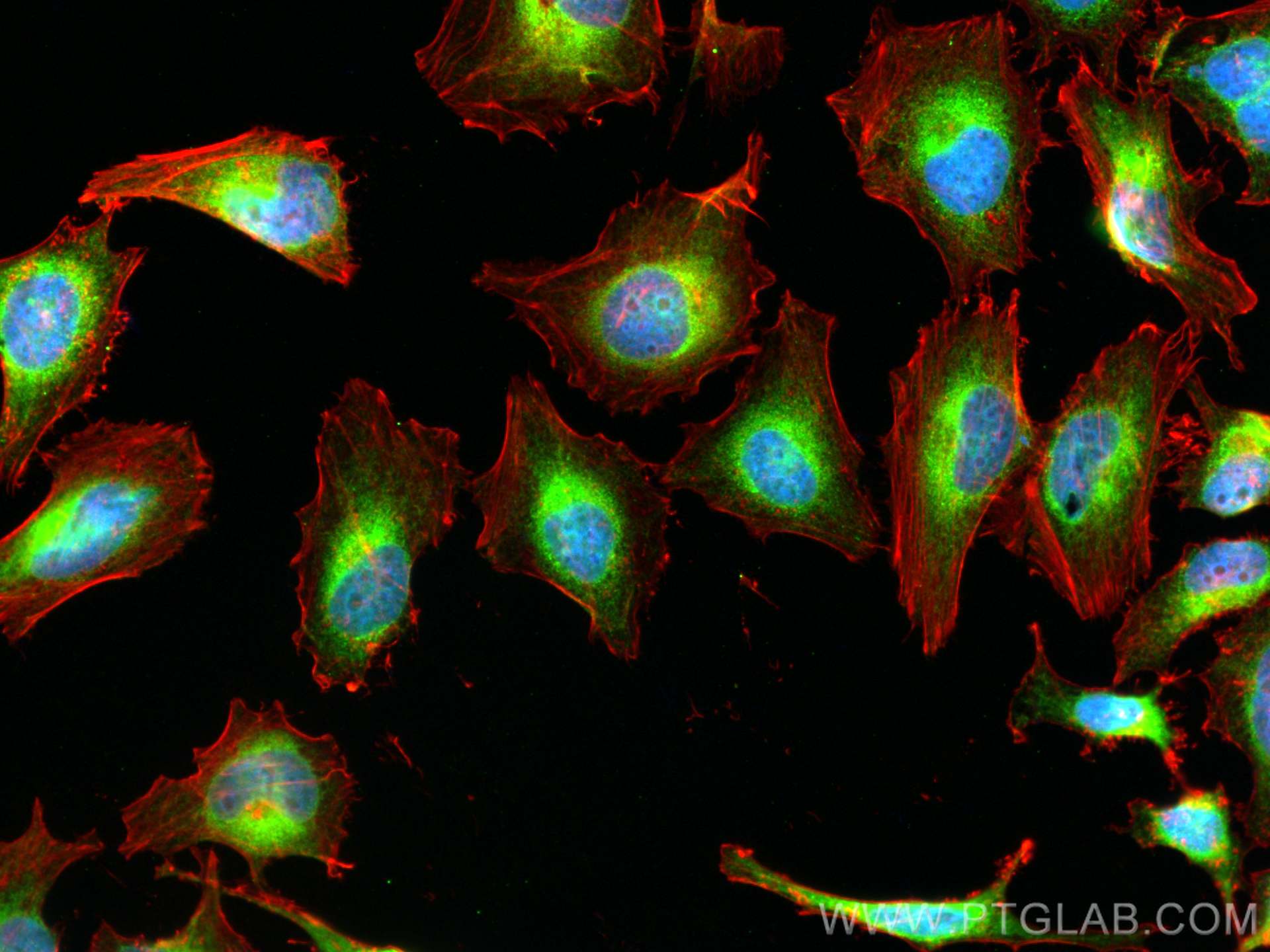 Immunofluorescence (IF) / fluorescent staining of HeLa cells using GRP94 Polyclonal antibody (14700-1-AP)