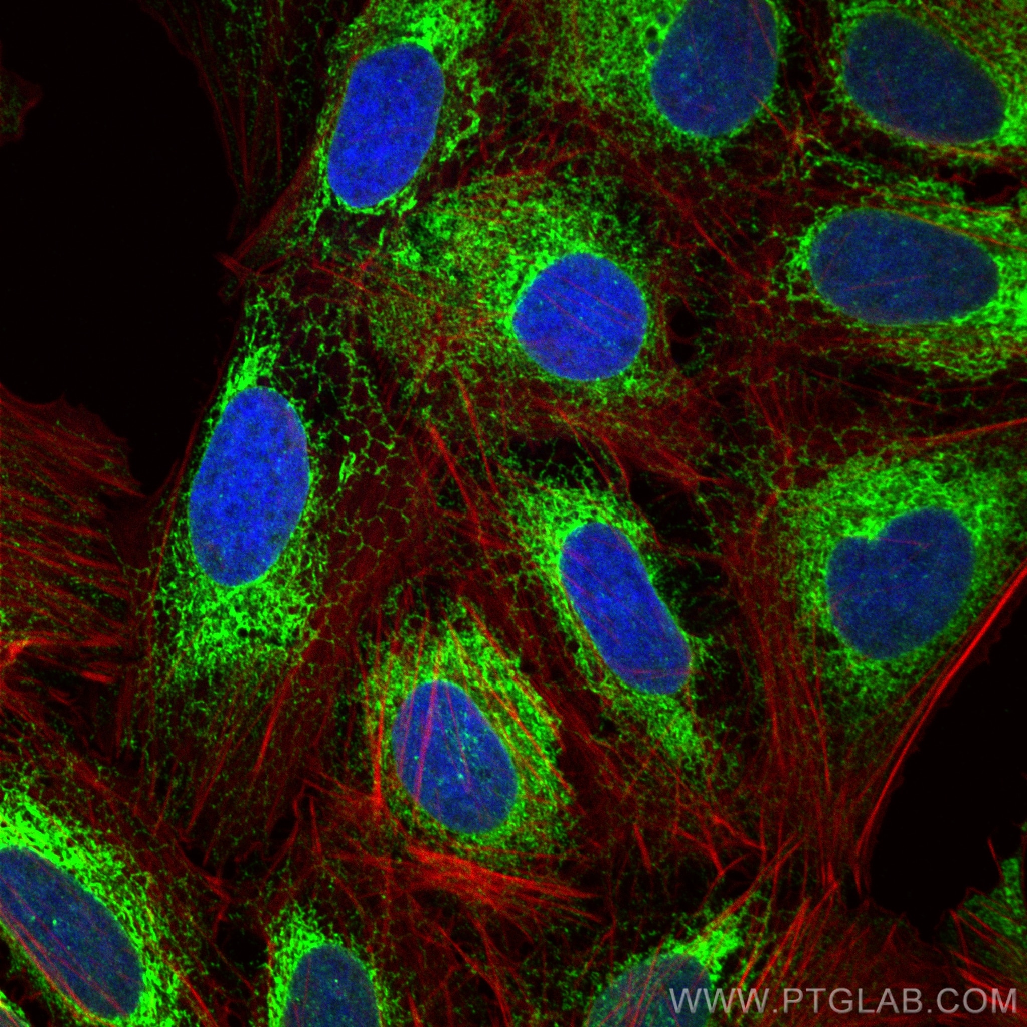 Immunofluorescence (IF) / fluorescent staining of U2OS cells using GRP94 Polyclonal antibody (14700-1-AP)