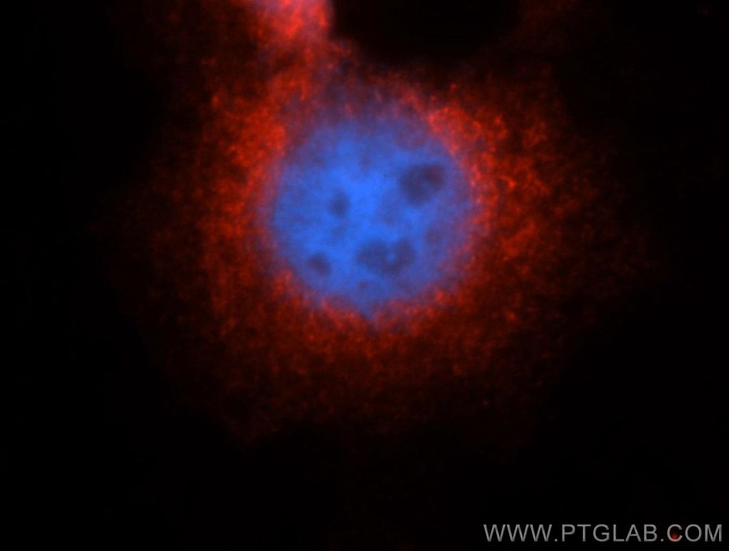 Immunofluorescence (IF) / fluorescent staining of A431 cells using GRP94 Polyclonal antibody (14700-1-AP)