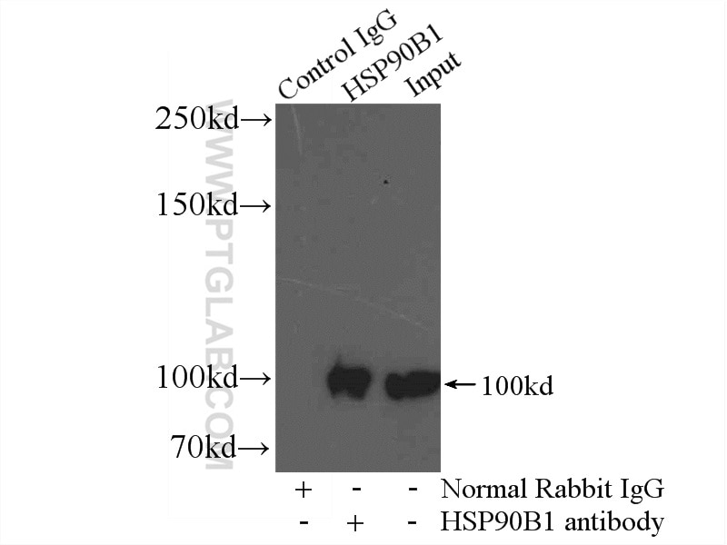 Immunoprecipitation (IP) experiment of mouse liver tissue using GRP94 Polyclonal antibody (14700-1-AP)