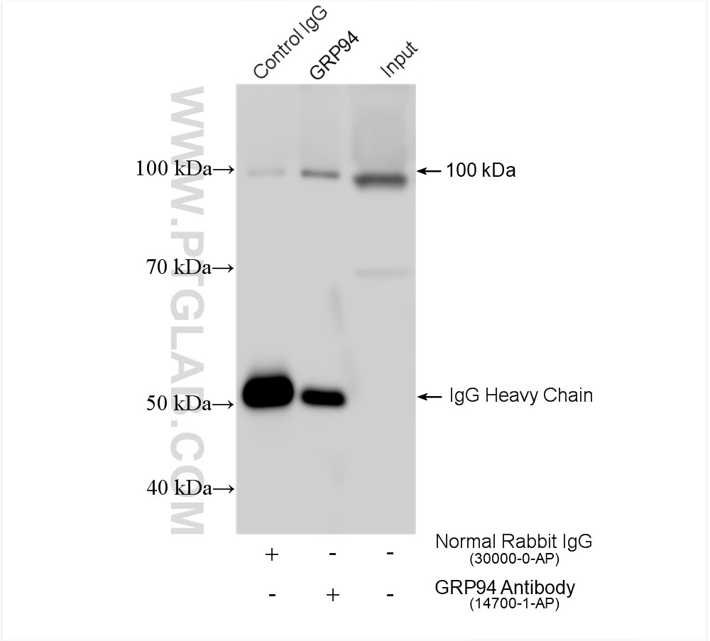 Immunoprecipitation (IP) experiment of mouse liver tissue using GRP94 Polyclonal antibody (14700-1-AP)