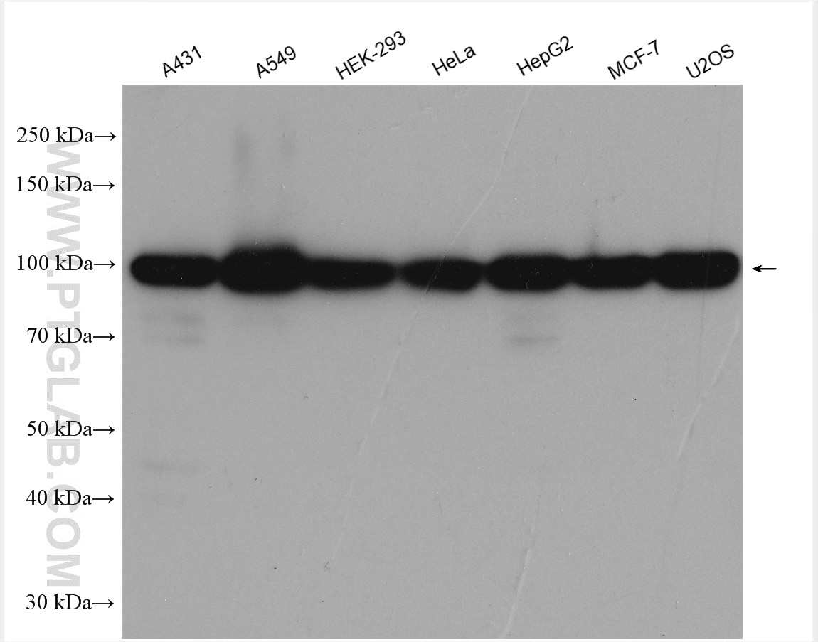 Western Blot (WB) analysis of various lysates using GRP94 Polyclonal antibody (14700-1-AP)