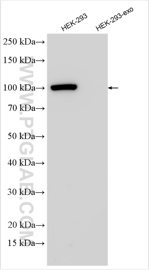 Western Blot (WB) analysis of HEK-293 cells using GRP94 Polyclonal antibody (14700-1-AP)