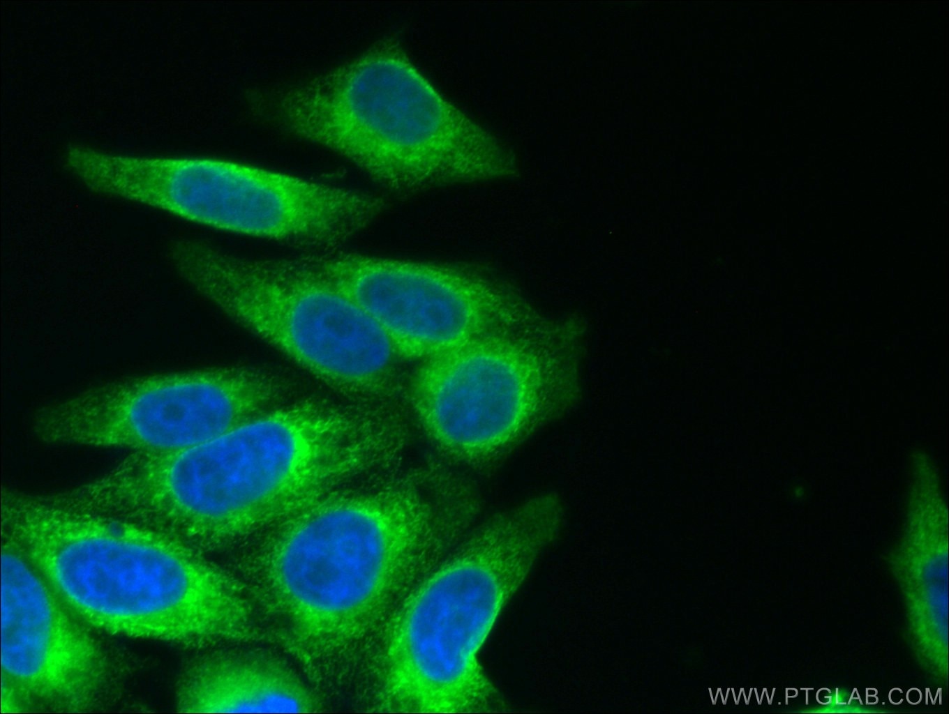 Immunofluorescence (IF) / fluorescent staining of HepG2 cells using GRP94 Monoclonal antibody (60012-1-Ig)