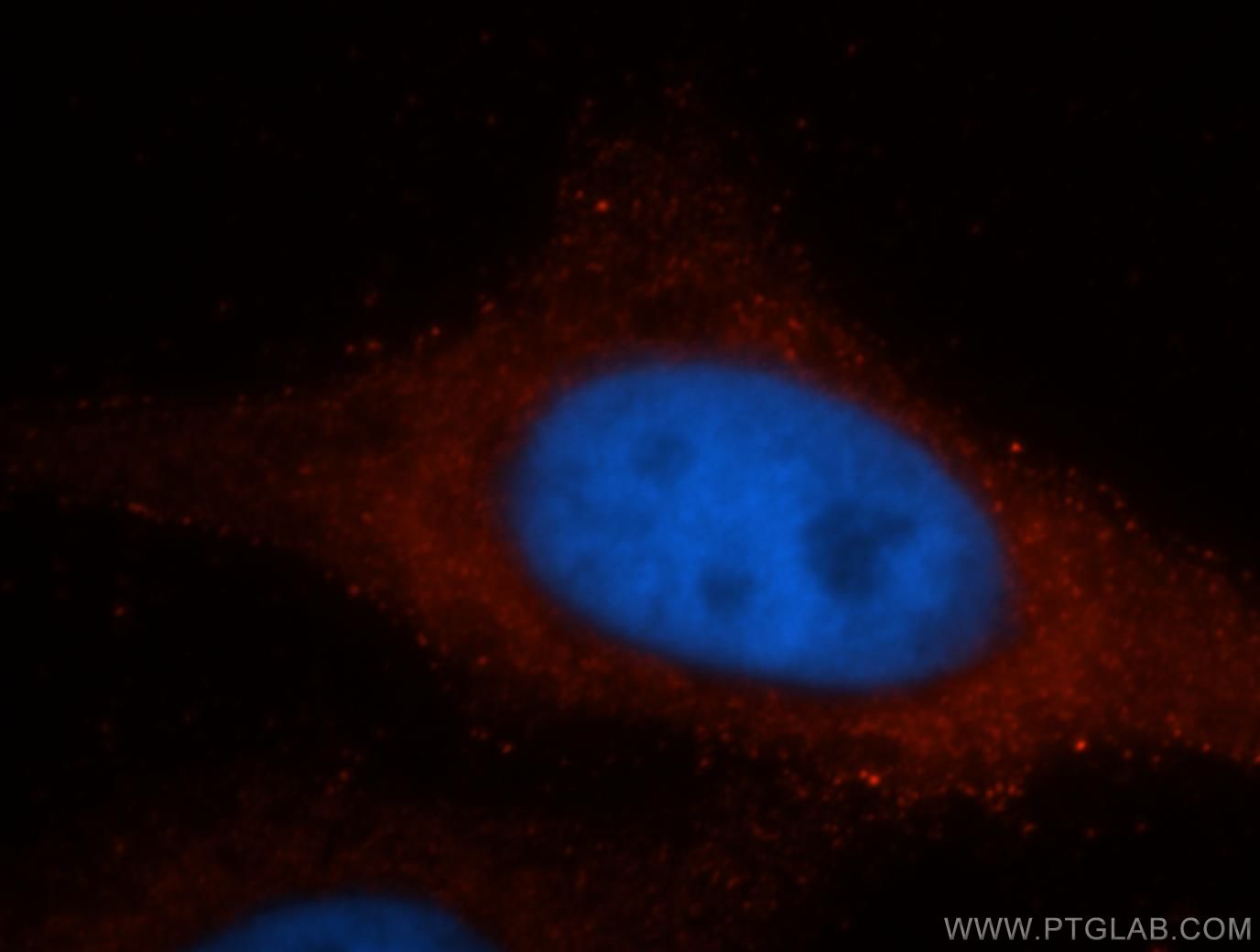 Immunofluorescence (IF) / fluorescent staining of HepG2 cells using GRP94 Monoclonal antibody (60012-1-Ig)