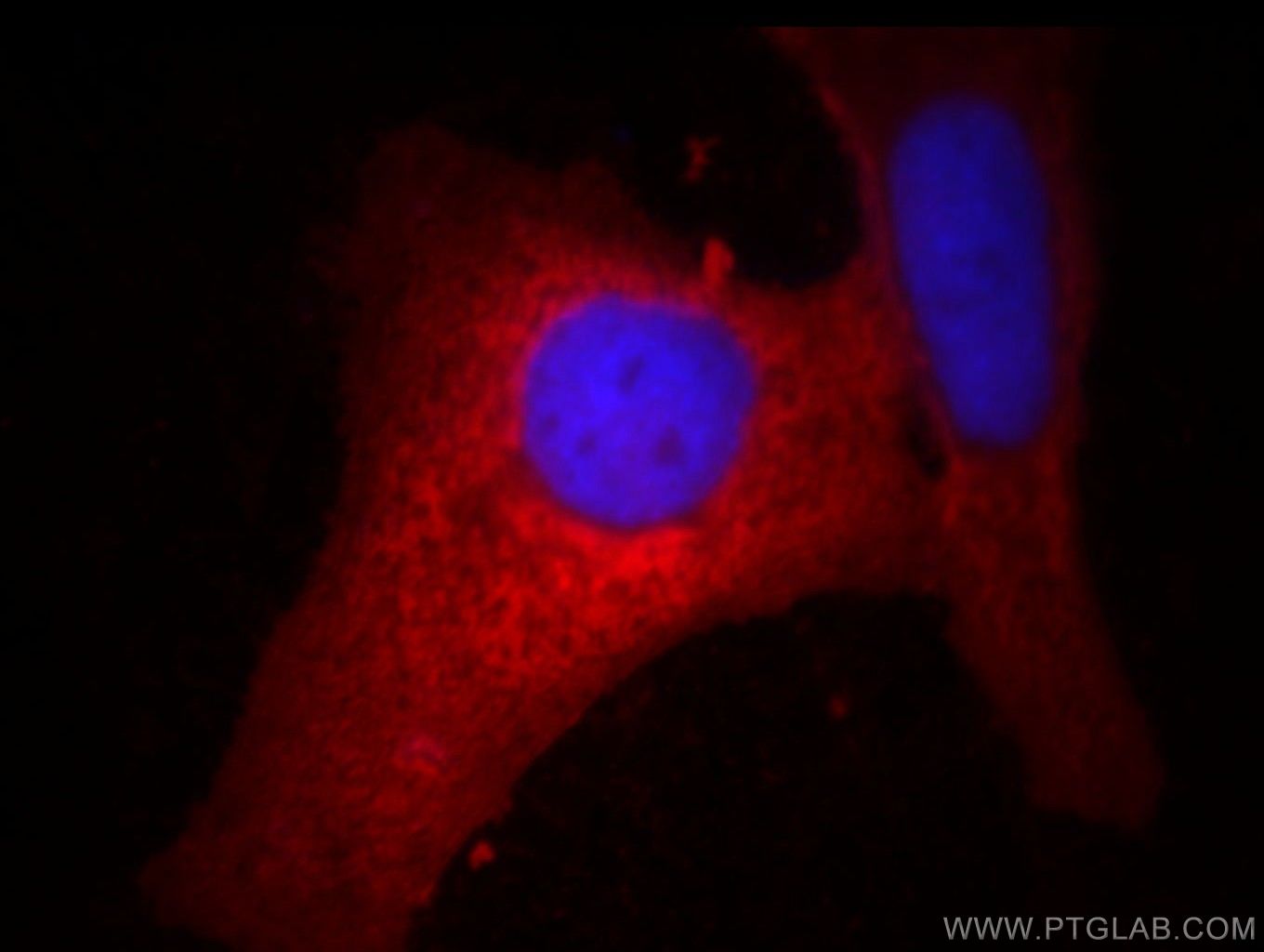 Immunofluorescence (IF) / fluorescent staining of HeLa cells using GRP94 Monoclonal antibody (60012-1-Ig)