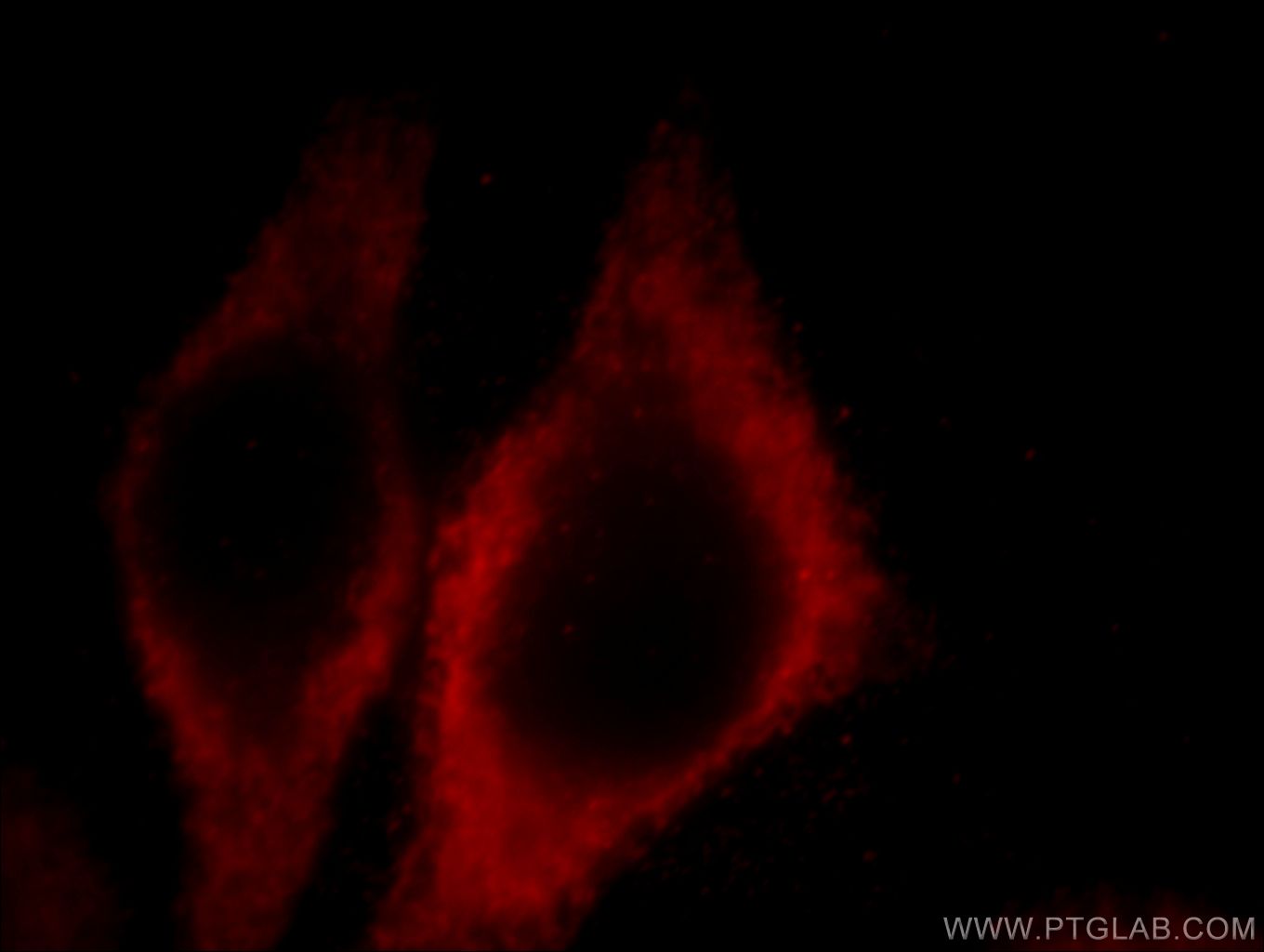 Immunofluorescence (IF) / fluorescent staining of MCF-7 cells using GRP94 Monoclonal antibody (60012-1-Ig)