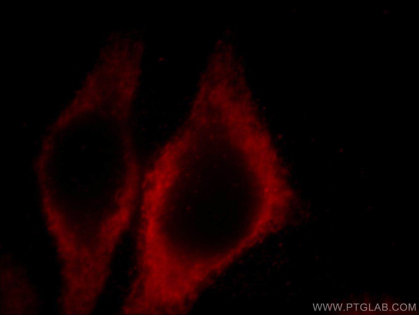 IF Staining of MCF-7 using 60012-1-Ig