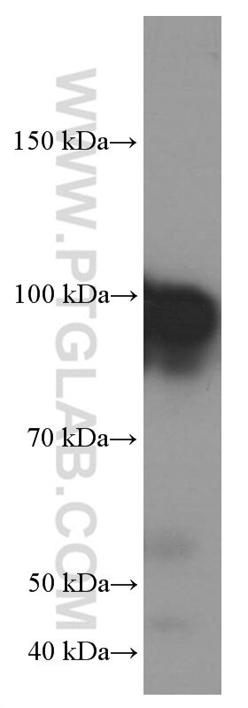 Western Blot (WB) analysis of ROS1728 cells using GRP94 Monoclonal antibody (60012-1-Ig)