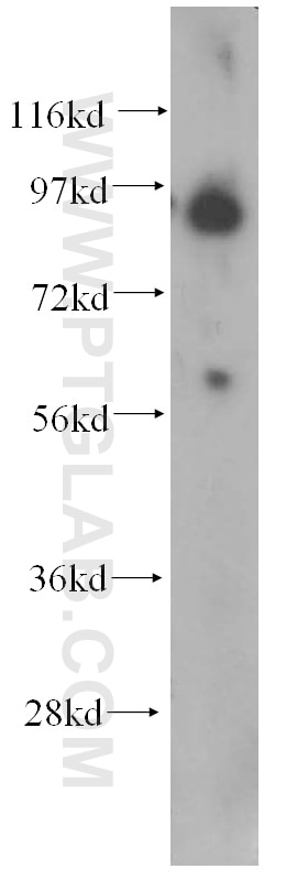 Western Blot (WB) analysis of human liver tissue using GRP94 Monoclonal antibody (60012-1-Ig)