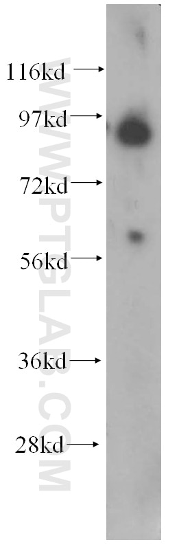 WB analysis of human liver using 60012-1-Ig