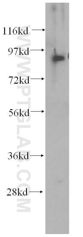 WB analysis of human lung using 60012-1-Ig