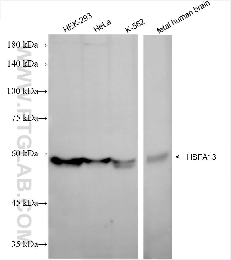 Western Blot (WB) analysis of various lysates using HSPA13 Recombinant antibody (84426-5-RR)