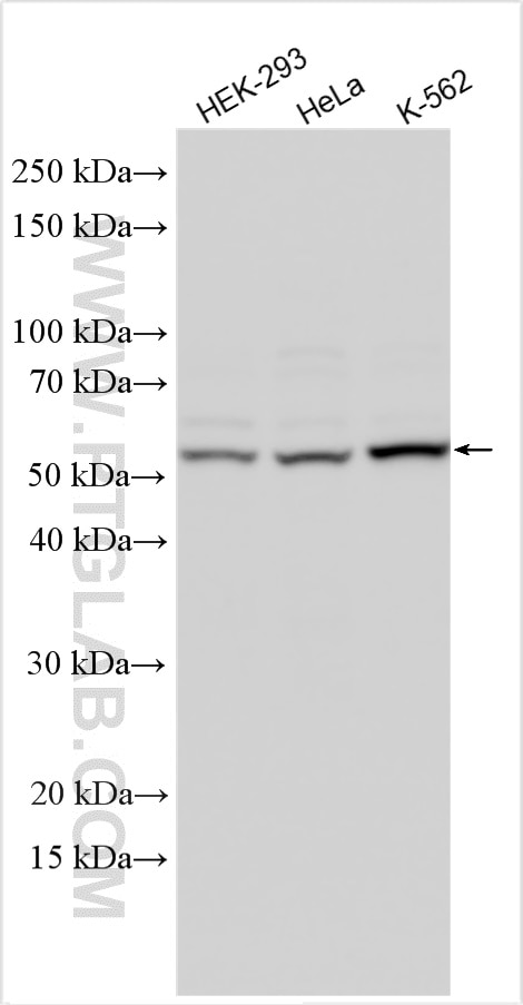 Western Blot (WB) analysis of various lysates using HSPA14 Polyclonal antibody (28503-1-AP)