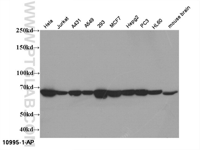 HSP70 Polyclonal antibody