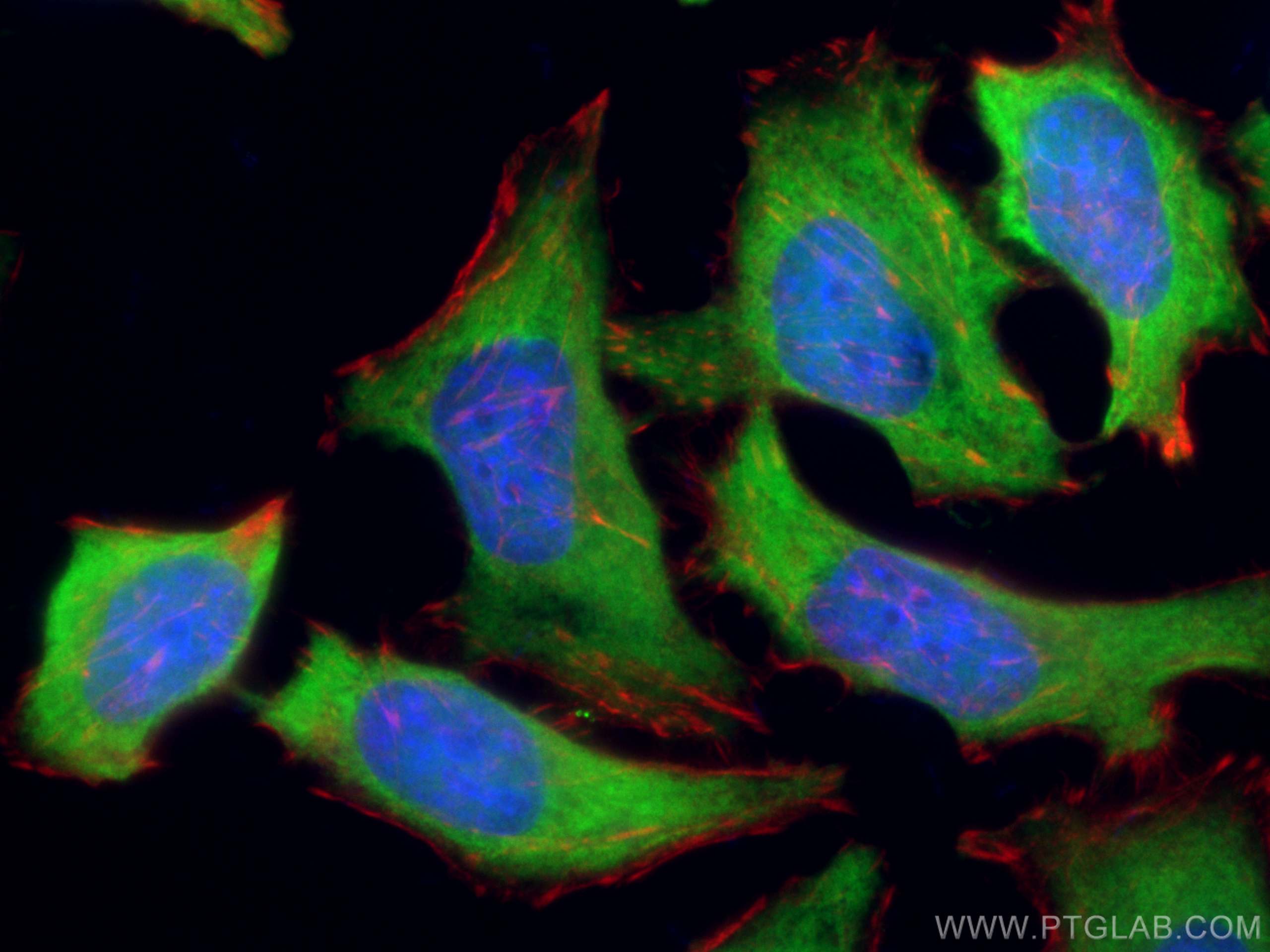 IF Staining of HeLa using 10995-1-AP