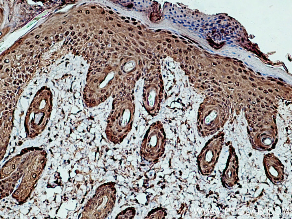 Immunohistochemistry (IHC) staining of mouse skin tissue using HSP70 Polyclonal antibody (10995-1-AP)