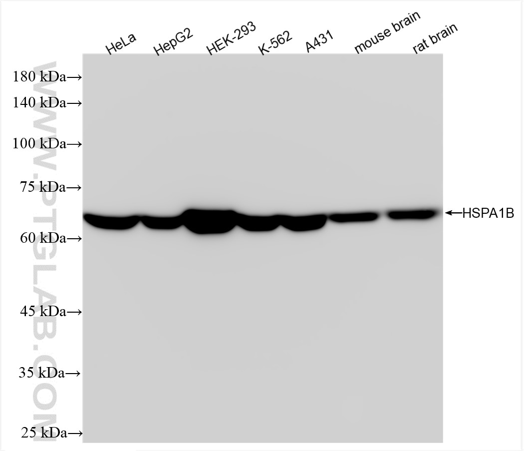 Western Blot (WB) analysis of various lysates using HSPA1B Recombinant antibody (84873-4-RR)