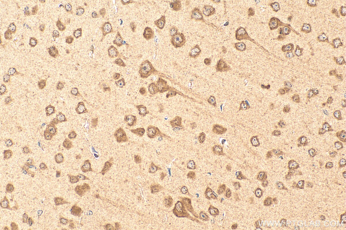 Immunohistochemistry (IHC) staining of mouse brain tissue using HSPA1L Polyclonal antibody (13970-1-AP)