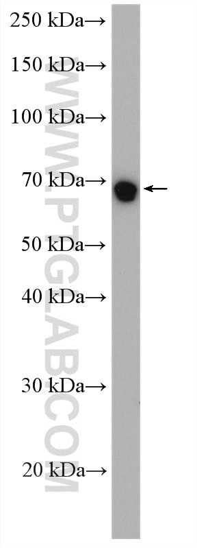 Western Blot (WB) analysis of human saliva using HSPA1L Polyclonal antibody (13970-1-AP)