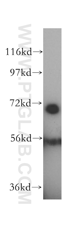 Western Blot (WB) analysis of MCF-7 cells using HSPA1L Polyclonal antibody (13970-1-AP)