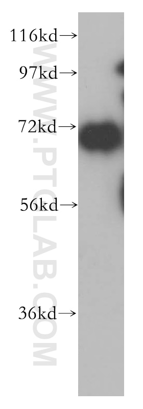 Western Blot (WB) analysis of HeLa cells using HSPA1L Polyclonal antibody (13970-1-AP)