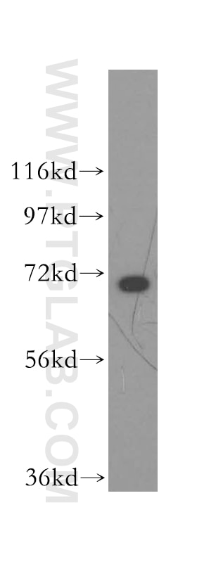 Western Blot (WB) analysis of HepG2 cells using HSPA1L Polyclonal antibody (13970-1-AP)