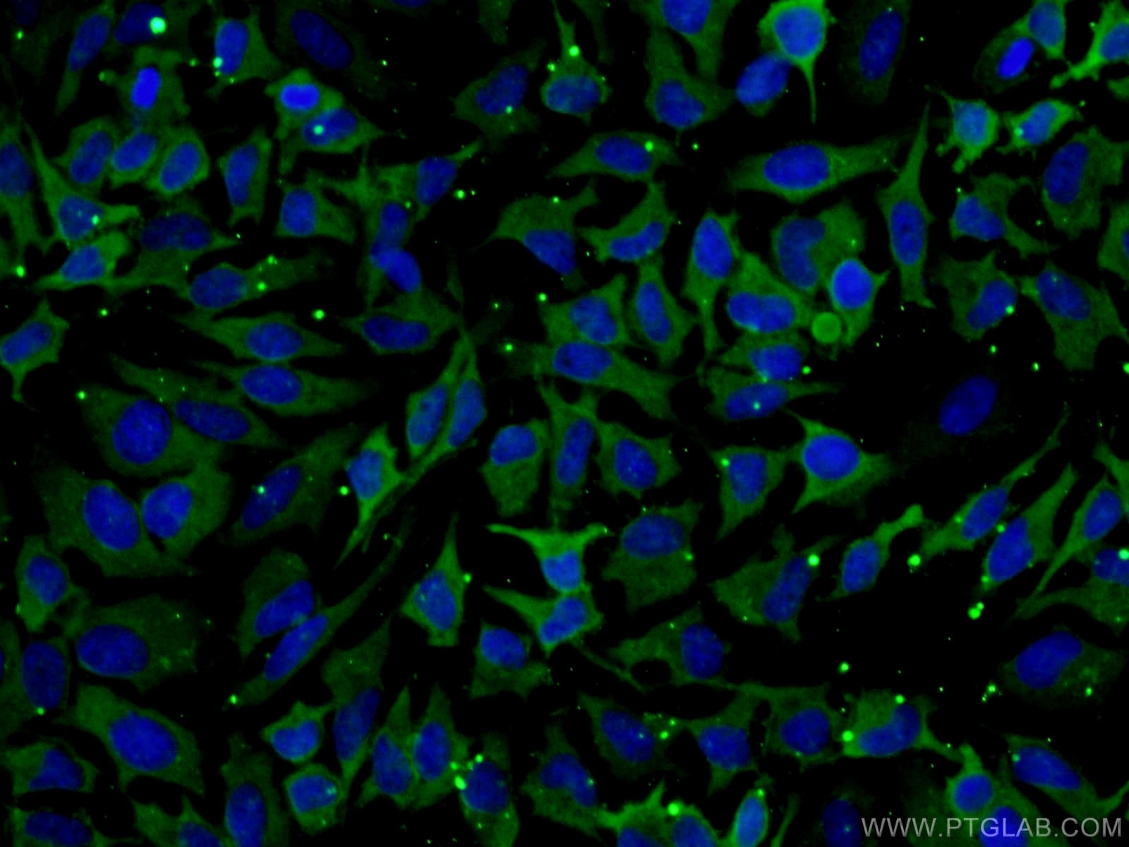 Immunofluorescence (IF) / fluorescent staining of HeLa cells using HSPA1L Monoclonal antibody (66780-1-Ig)