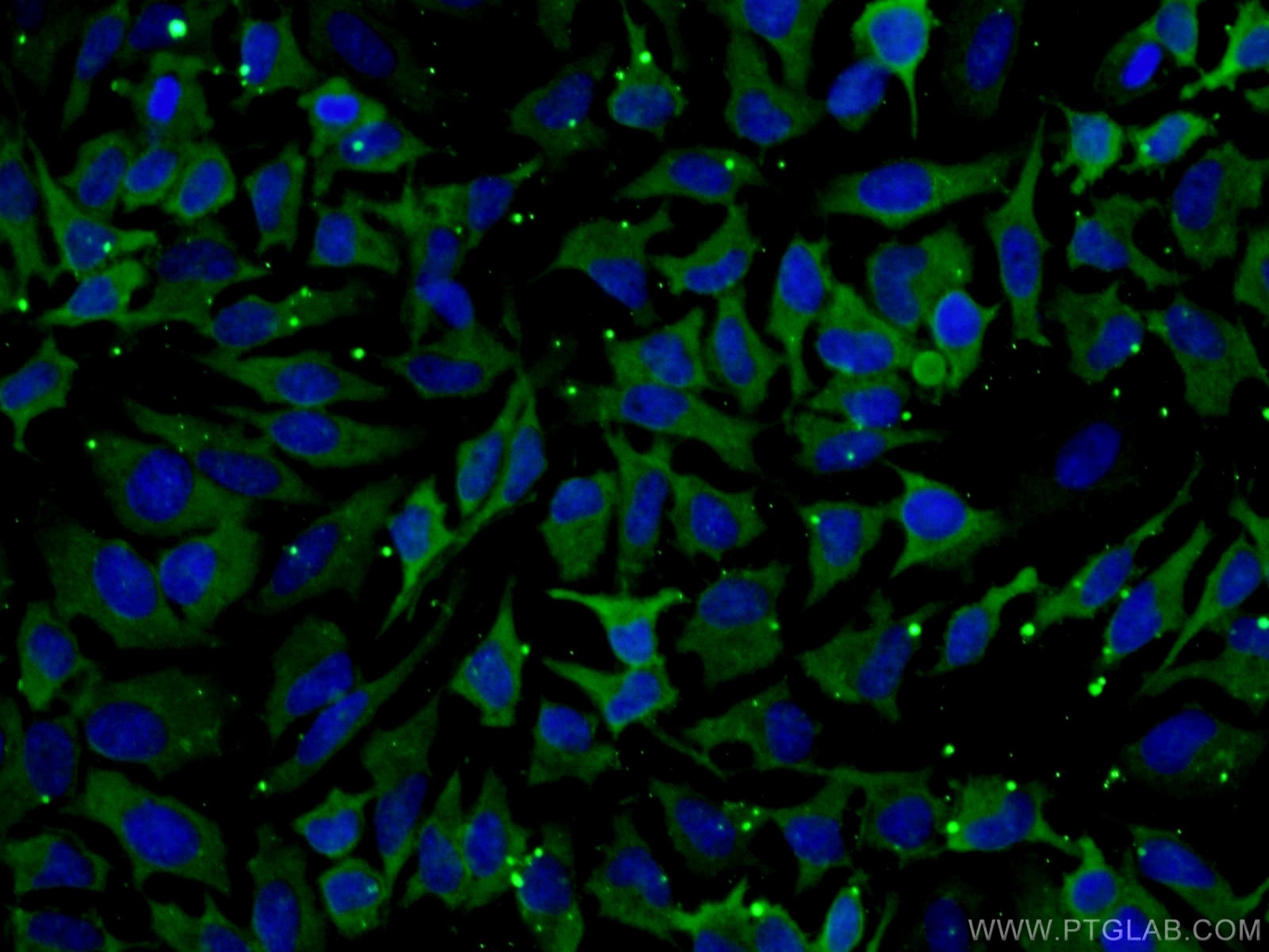Immunofluorescence (IF) / fluorescent staining of HeLa cells using HSPA1L Monoclonal antibody (66780-1-Ig)