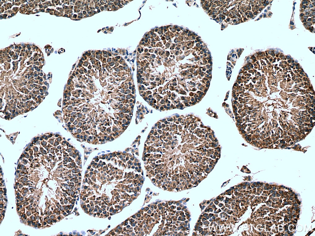 Immunohistochemistry (IHC) staining of mouse testis tissue using HSPA1L Monoclonal antibody (66780-1-Ig)