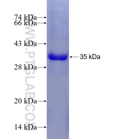 HSPA1L fusion protein Ag5182 SDS-PAGE