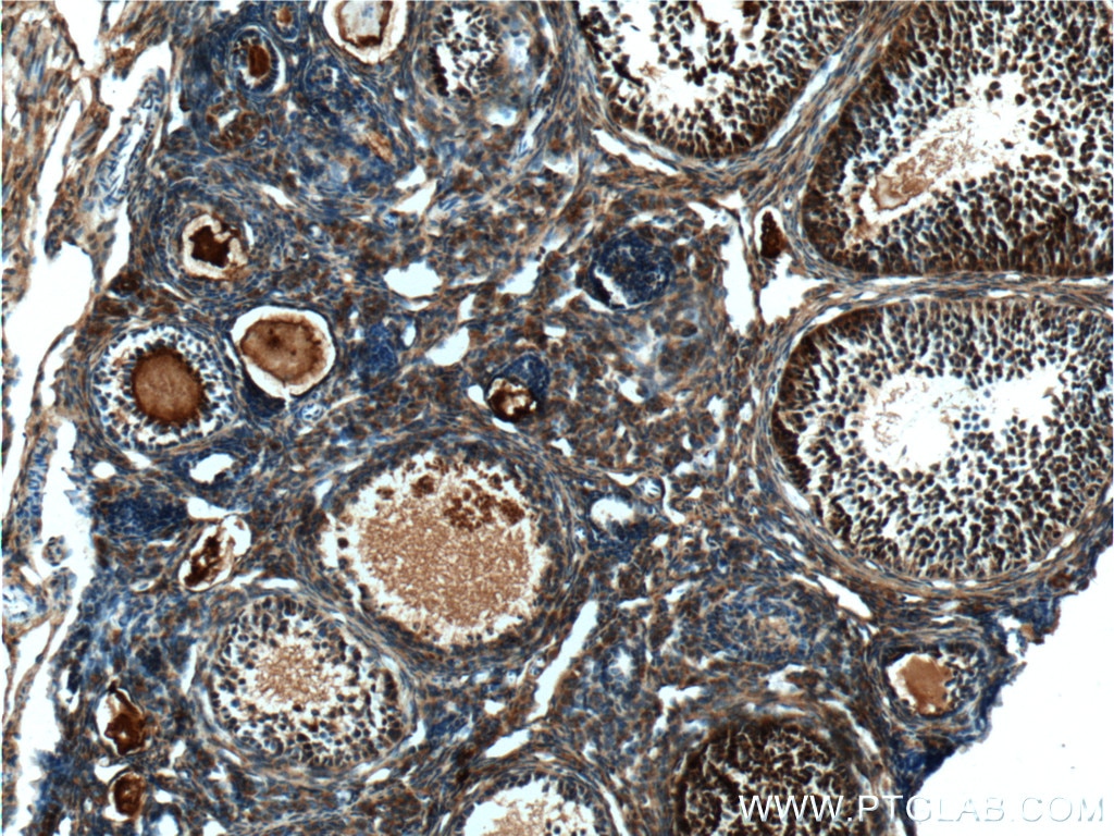 Immunohistochemistry (IHC) staining of mouse ovary tissue using HSPA2 Polyclonal antibody (12797-1-AP)