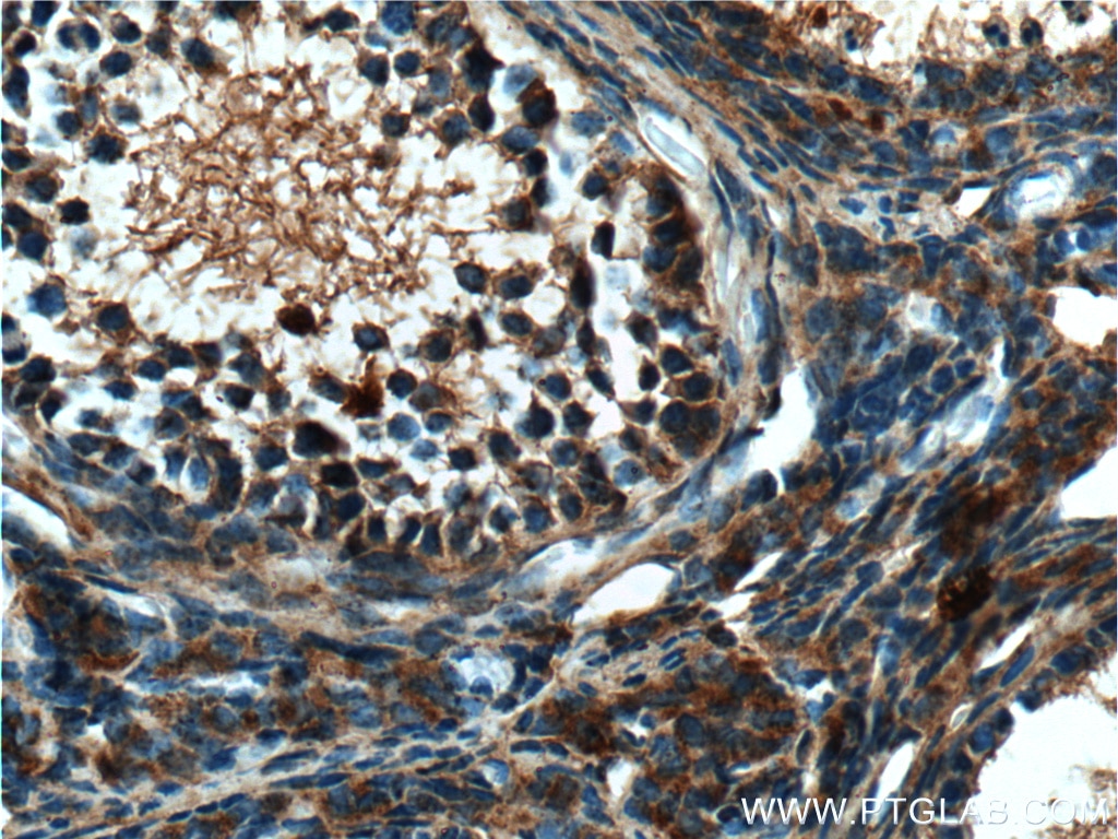 Immunohistochemistry (IHC) staining of mouse ovary tissue using HSPA2 Polyclonal antibody (12797-1-AP)