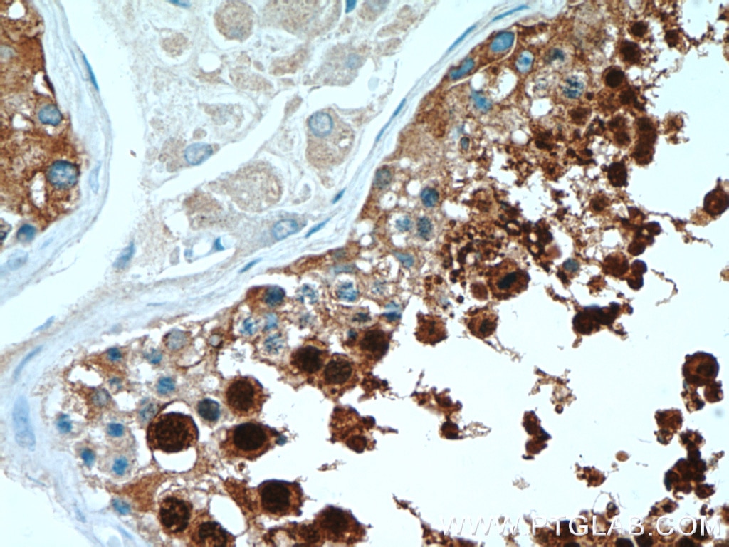 Immunohistochemistry (IHC) staining of human testis tissue using HSPA2 Polyclonal antibody (12797-1-AP)